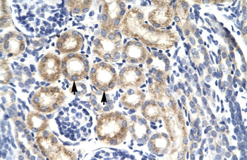 CSEN Rabbit Polyclonal Antibody