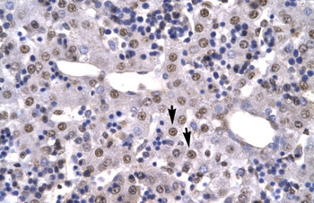 HMGB2 Rabbit Polyclonal Antibody