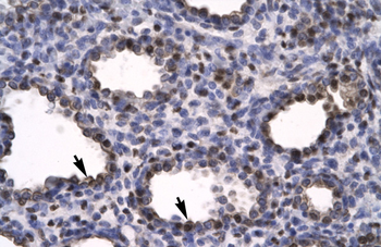 HMGB2 Rabbit Polyclonal Antibody