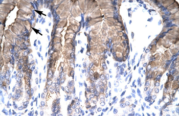 NR4A1 Rabbit Polyclonal Antibody