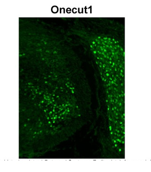 Onecut1 Rabbit Polyclonal Antibody