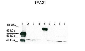 SMAD1 Rabbit Polyclonal Antibody