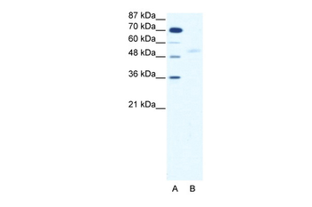 SMAD5 Rabbit Polyclonal Antibody
