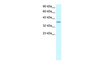 SMAD7 Rabbit Polyclonal Antibody