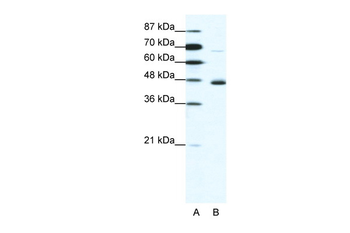NEUROD1 Rabbit Polyclonal Antibody