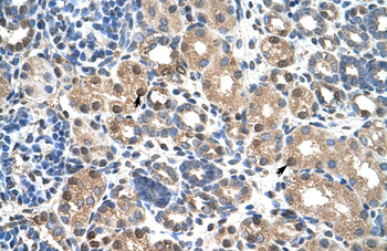 PBX3 Rabbit Polyclonal Antibody
