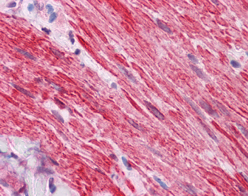 DVL2 Rabbit Polyclonal Antibody