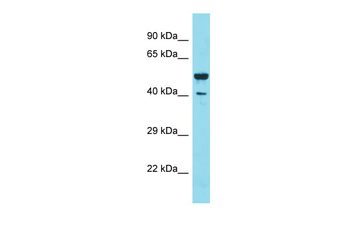 DVL2 Rabbit Polyclonal Antibody