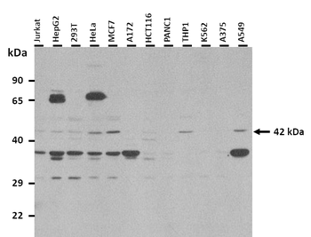 WNT5A Rabbit Polyclonal Antibody