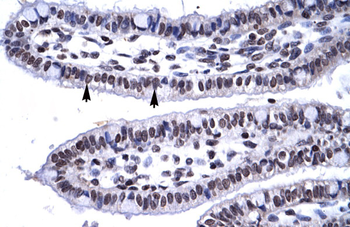 MYF6 Rabbit Polyclonal Antibody