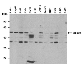 EGR1 Rabbit Polyclonal Antibody