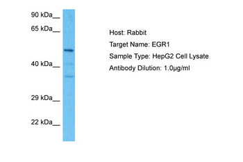 EGR1 Rabbit Polyclonal Antibody