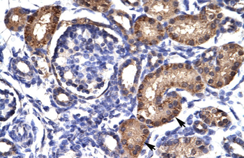 AHR Rabbit Polyclonal Antibody