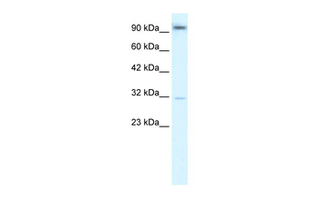 AHR Rabbit Polyclonal Antibody