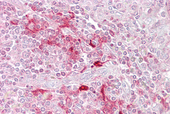 ETV5 Rabbit Polyclonal Antibody