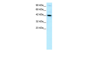 HNF1B Rabbit Polyclonal Antibody