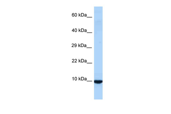 Id3 Rabbit Polyclonal Antibody