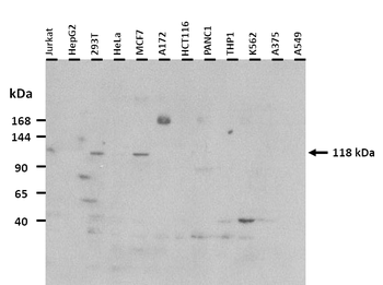 GLI1 Rabbit Polyclonal Antibody