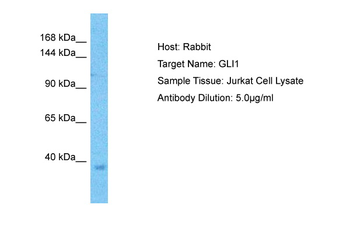 GLI1 Rabbit Polyclonal Antibody