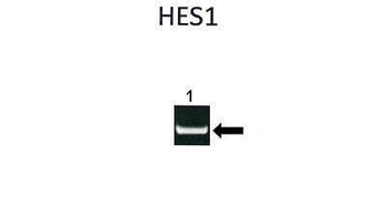 HES1 Rabbit Polyclonal Antibody