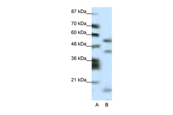 LHX1 Rabbit Polyclonal Antibody
