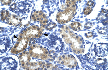 SIX6 Rabbit Polyclonal Antibody