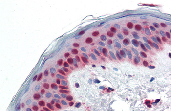 PAX7 Rabbit Polyclonal Antibody