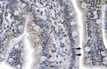 LEF1 Rabbit Polyclonal Antibody