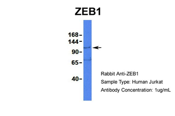 ZEB1 Rabbit Polyclonal Antibody
