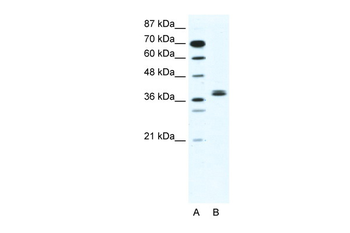 BHLHB5 Rabbit Polyclonal Antibody
