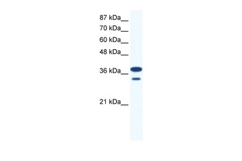 LHX3 Rabbit Polyclonal Antibody