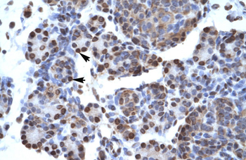CTBP1 Rabbit Polyclonal Antibody