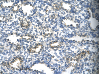 SUV39H1 Rabbit Polyclonal Antibody