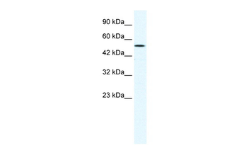 SUV39H1 Rabbit Polyclonal Antibody