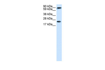 CBX5 Rabbit Polyclonal Antibody