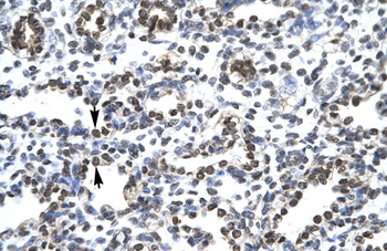 CIC Rabbit Polyclonal Antibody