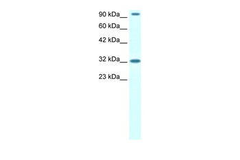 CIC Rabbit Polyclonal Antibody
