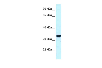 Hey1 Rabbit Polyclonal Antibody