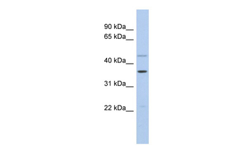 FOS Rabbit Polyclonal Antibody