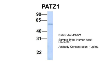 PATZ1 Rabbit Polyclonal Antibody
