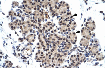 ZNF318 Rabbit Polyclonal Antibody