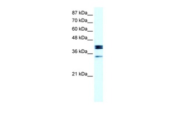 NR5A1 Rabbit Polyclonal Antibody