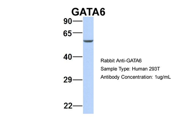 GATA6 Rabbit Polyclonal Antibody