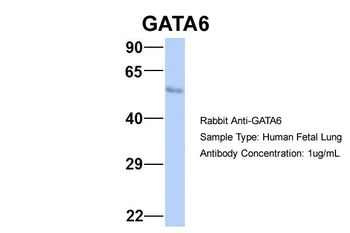 GATA6 Rabbit Polyclonal Antibody