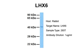 LHX6 Rabbit Polyclonal Antibody
