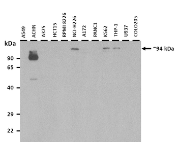 ZNF777 Rabbit Polyclonal Antibody