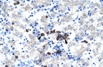 ABT1 Rabbit Polyclonal Antibody