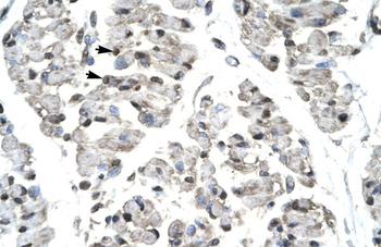 TBX21 Rabbit Polyclonal Antibody