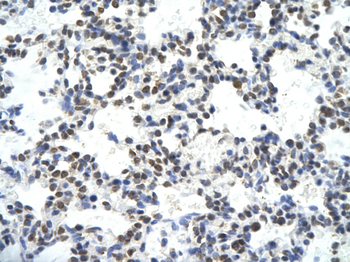 HDAC2 Rabbit Polyclonal Antibody