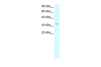 HOXD12 Rabbit Polyclonal Antibody